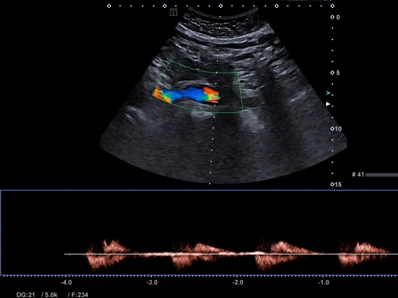 AORTA 2