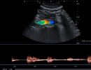 AORTA 5