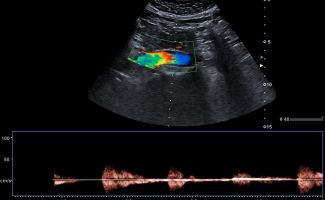 AORTA 5