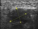 FOOT 6