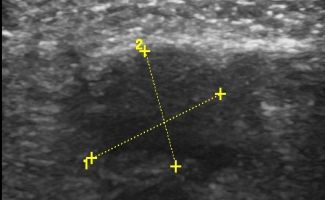 FOOT 6