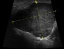 SALIVARY 17