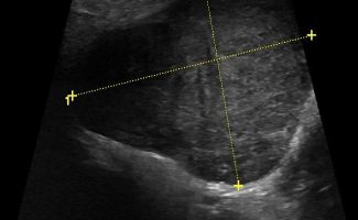 SALIVARY 17