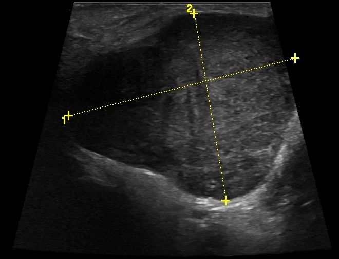 SALIVARY 17