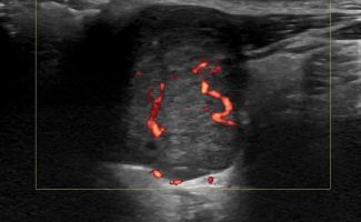 SALIVARY 2