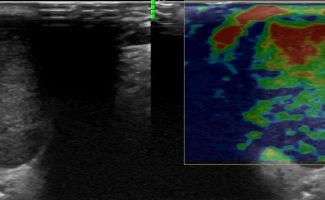 SALIVARY 3