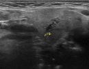 SALIVARY 4