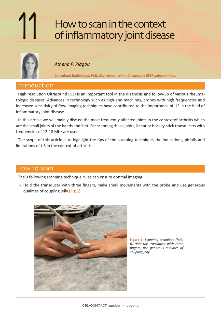 How to scan in the context of inflammatory joint disease